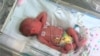 World Prematurity Day Aims to Lower Rates of Premature Births