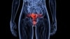 More Women Decline Cervical Cancer Vaccine