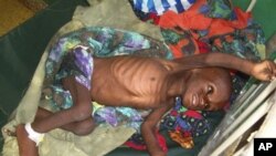 Uma criança com dois anos de idade, Abdirahman Arale, fotografada, na semana passada, no hospital de Banadir, em Mogadíscio
