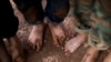 FILE - Displaced Syrian children gather barefoot in a refugee camp near Atma, Idlib province, Syria.